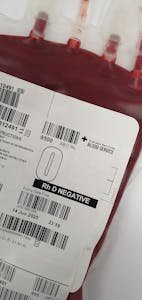 15 O Positive Blood Type Facts - Facts Opinions