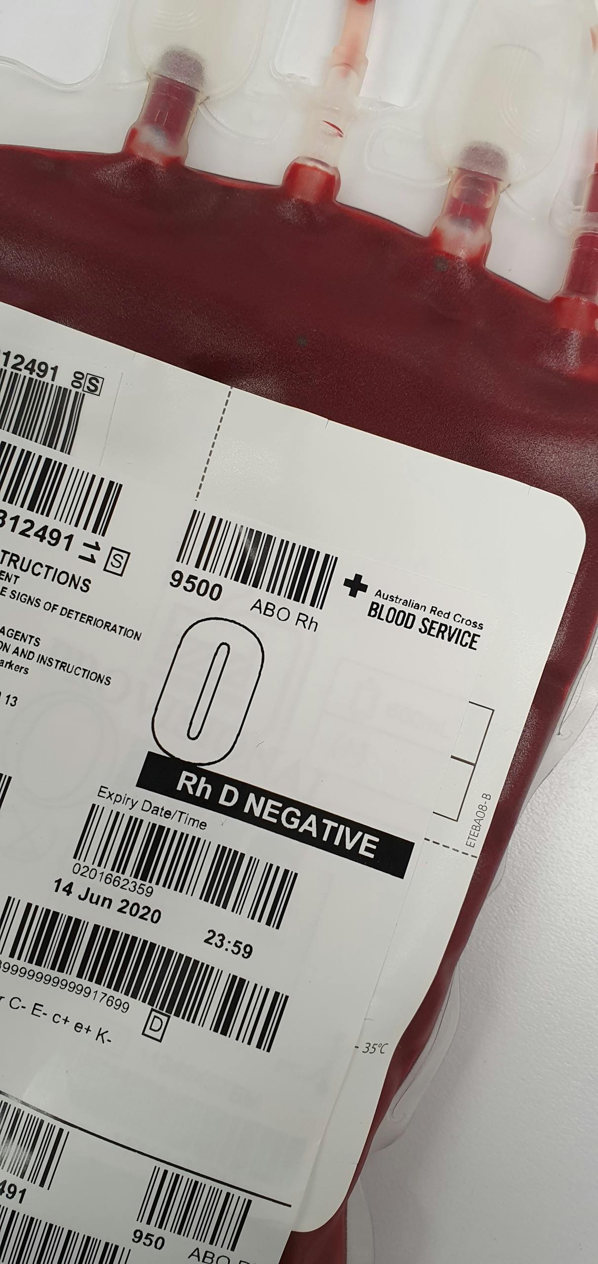 Detailed view of a blood bag labeled Rh D Negative for medical donation purposes.